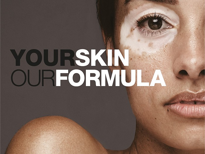 Θεραπεία Επανόρθωσης Χρόνιας Ερυθρότητας