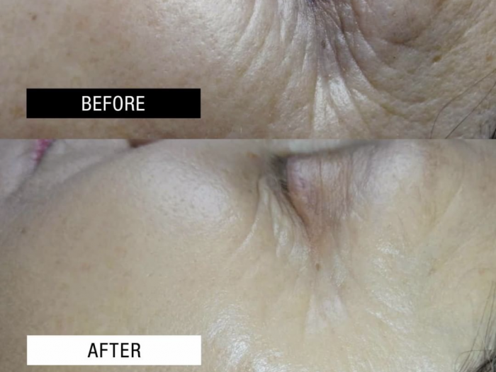 Θεραπεία Αναζωογόνησης Ηλικίας